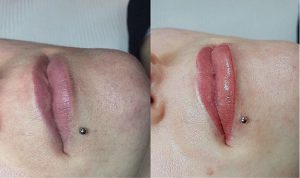 lips makeup before after